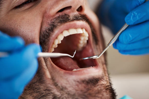 Best Full Mouth Reconstruction  in Rosaryville, MD
